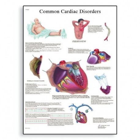 3B calculadora científica de tamaño normal Cardiac trastornos del diseño con la escala de